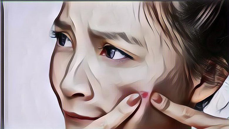 Obat Antibiotik Untuk Jerawat Yang Bagus, Cocok Banget!