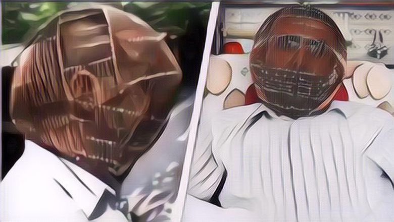 Kisah Seorang Pria yang Pasang Kerangkeng Kepala Agar Bisa Berhenti Merokok