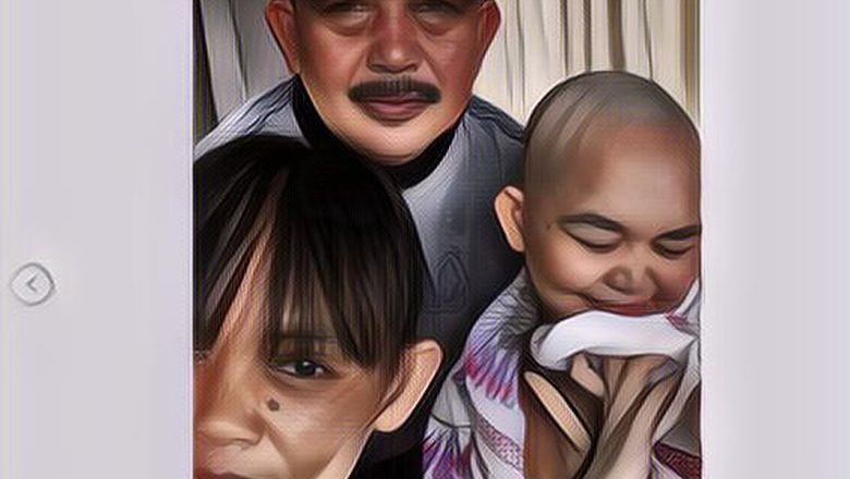 Divonis Kanker Otak, Gadis Cantik Botaki Rambut Ditemani Ayah dan Ibunya