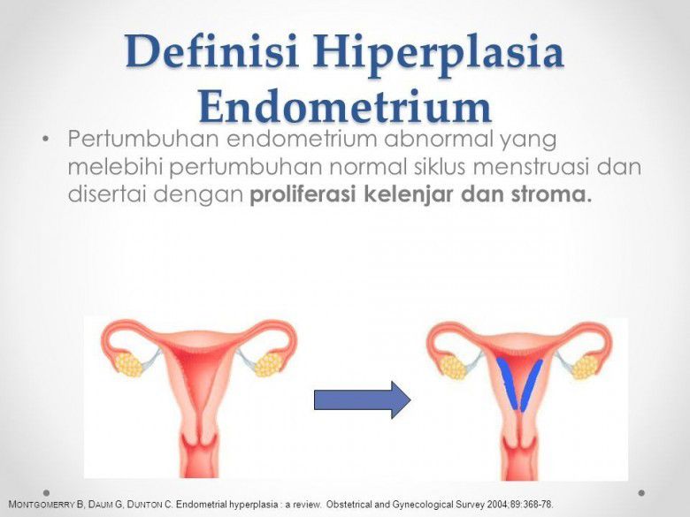 # Gejala Hiperplasia Endometrium