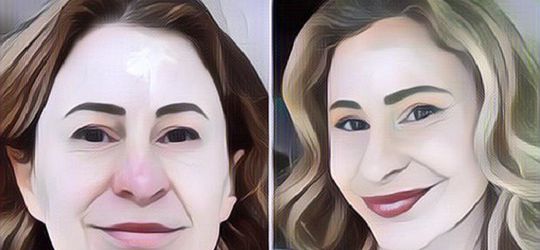 Miris! Wanita Ini Rela Jual Rumah Demi Bisa Operasi Plastik, Kini Hidupnya Hanya Di Dalam Van