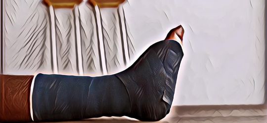 Berapa Lama Waktu yang Dibutuhkan untuk Sembuh dari Patah Tulang?