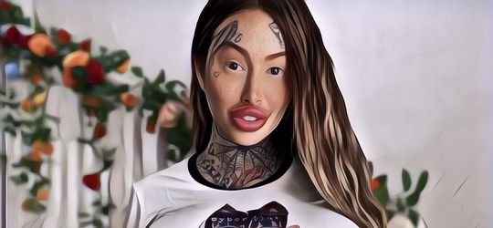 Ngeri Banget, Payudara Wanita Ini Seketika Meledak Sebelah Setelah Menjalani Oplas