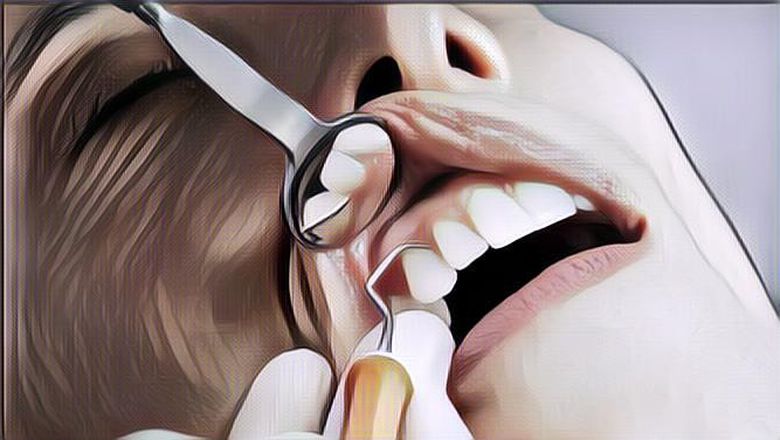 Coba Gunakan 4 Bahan Rumahan Ini untuk Bersihkan Karang Gigi, Terbukti Ampuh!