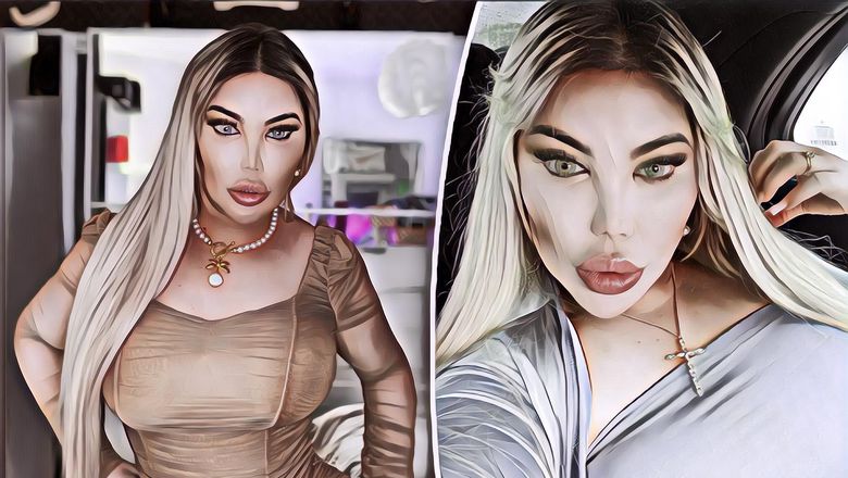 Ngeri, Bokong Transgender Ini Tiba-Tiba Meledak Gara-Gara Lebah