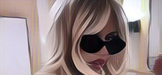 Duh Ngeri, Implan Payudara Influencer Ini Malah Berpindah ke Ketiak