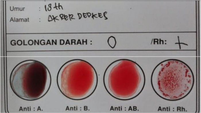 Ini Dia Urutan Golongan Darah Dari Yang Paling Umum Sampai Yang Langka