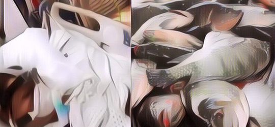 Miris! Wanita Ini Nyaris Tewas Gara-Gara Makan Ikan Nila, Kini Harus Kehilangan Anggota Tubuh