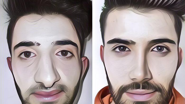 Seorang Pria Lakukan Operasi Plastik, Wajahnya Bikin Terkejut Hingga Diminta Warganet Ganti Foto Paspor