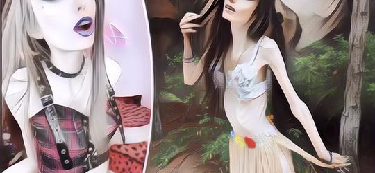 YouTuber Anoreksia Ini Terlihat Makin Kurus, Netizen Sibuk Telfon 911