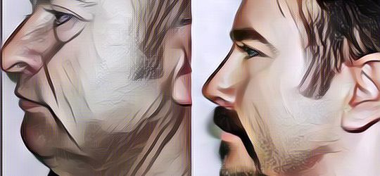 Viral Lansia yang Oplas, Hasilnya Jadi Lebih Muda 20 Tahun