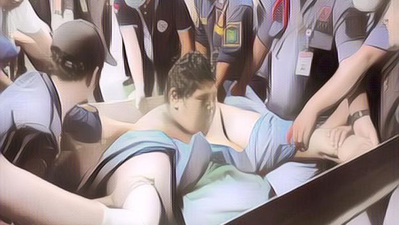 4 Kasus Obesitas di Indonesia, Ada Pasien yang Meninggal Dunia