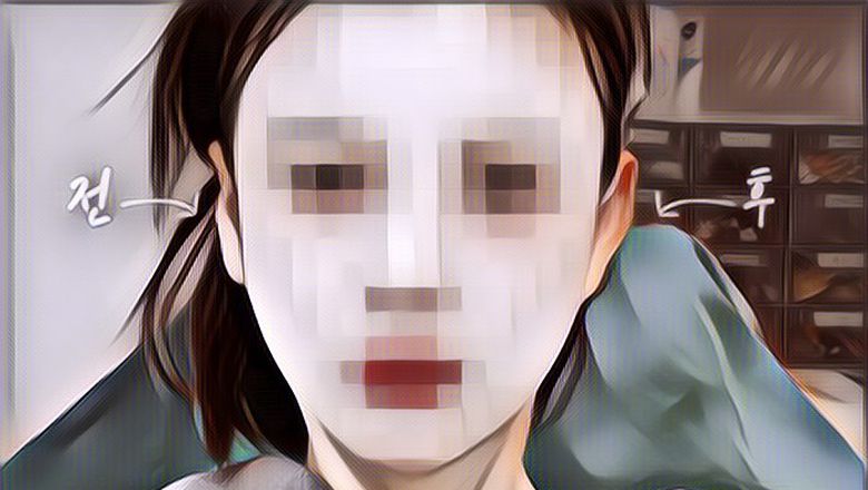 Orang Korea Sedang Tren Lakukan Filler 'Aneh' Ini, Terinspirasi dari Haerin Newjeans