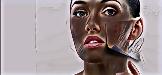 Manfaat Vaseline Petroleum Jelly Untuk Jerawat, Terbukti Ampuh!