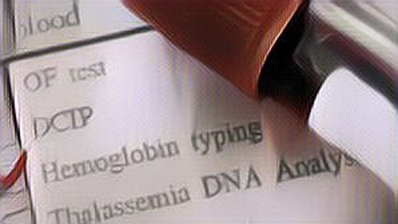 Penyebab dan Gejala Hb-mu Rendah, Jangan Sepelekan!