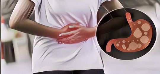 Tips Cegah Asam Lambung Agar Tidak Naik ke Tenggorokan