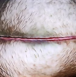 Penyebab dan Cara Menghilangkan Keloid atau Bekas Luka yang Menonjol