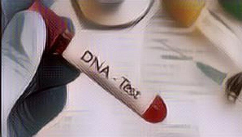 Seluk Beluk Tes Genetik atau DNA dan Seberapa Penting Mengetahui Hasilnya?