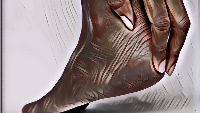 Ini Deretan Cara Atasi Tumit Kaki Pecah-pecah Secara Alami, Bye-bye Kulit Kasar!