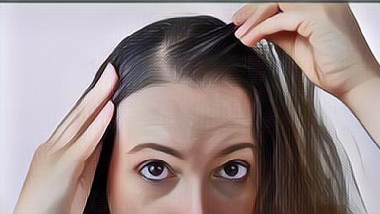 4 Penyebab Uban Tumbuh di Usia Muda Jika Bukan Karena Faktor Gen