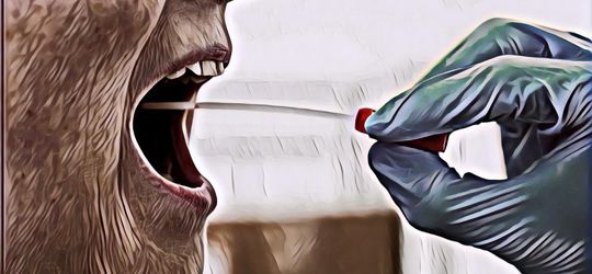 Buat yang Belum Tahu  Rapid Test Antigen Sama Rapid Test Antibodi, Jangan Salah Tes Loh