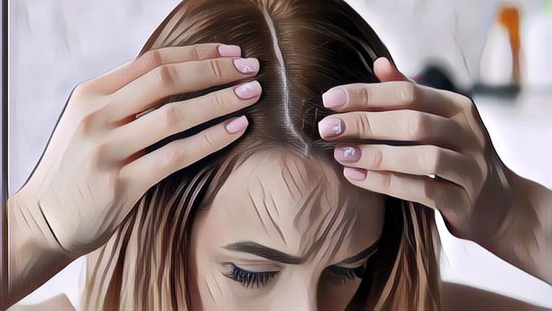 Kopi Bisa Atasi Rambut Rontok? Berikut Faktanya