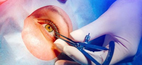 Bisa Sembuhkan Mata Minus, Ini 4 Fakta Operasi Lasik Mata yang Wajib Dipahami Pasien