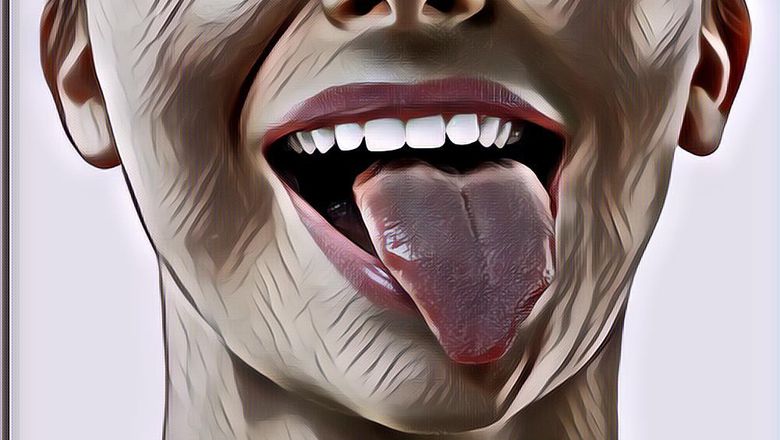 Luka di Lidah? Sembuhkan Dengan Bahan Alami Ini