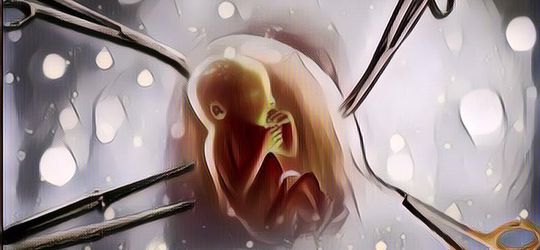 OMG! Aktor Senior 'Grandpas Over Flower' Kim Yong-Gun Paksa Pacarnya untuk Aborsi Karena Alasan Usia Lanjut