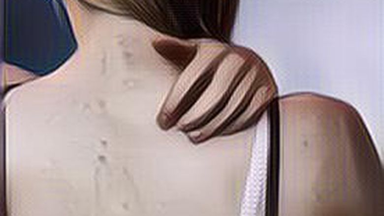 Kamu Punya Jerawat Punggung yang Mengganggu? Coba Pakai Bahan Alami Ini untuk Mengatasinya