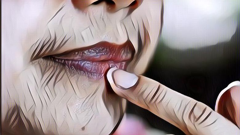 Waspada Penyebab Bibir Hitam, Kamu Ngalamin Nggak?