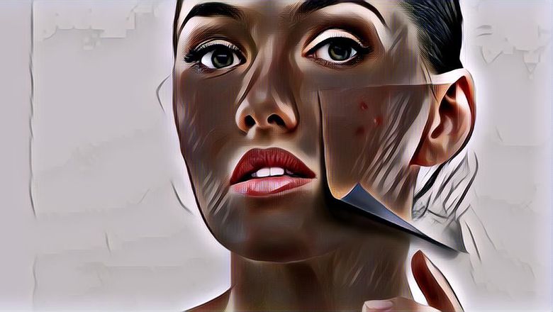 Manfaat Vaseline Petroleum Jelly Untuk Jerawat, Terbukti Ampuh!