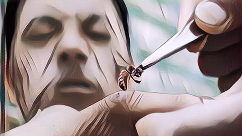 Sengatan Lebah Bisa Digunakan Sebagai Pengobatan Untuk Manusia, Hoax atau Fakta?