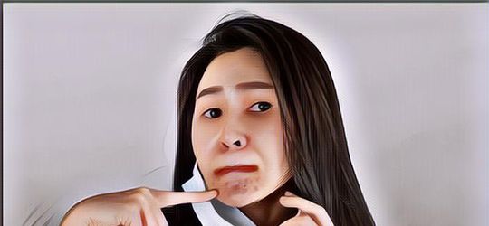 3 Cara Mengatasi Wajah Breakout Tanpa Skincare, Mau Mencoba?