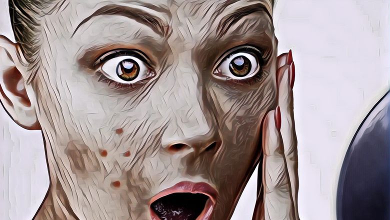 Jangan Panik, Jerat Jerawat dengan Lima Langkah Sederhana Ini!