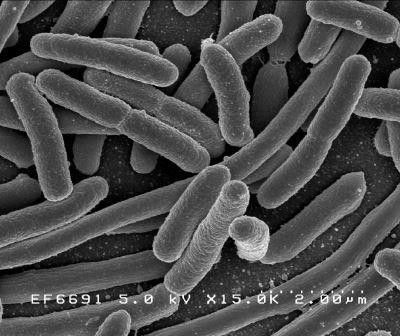 #2 E. coli