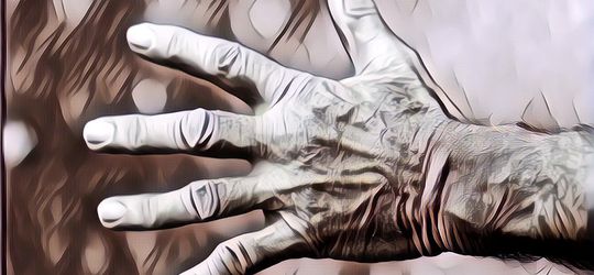 Alien Hand Syndrome, Kalau Kena Bisa Punya Tangan Alien Gitu?