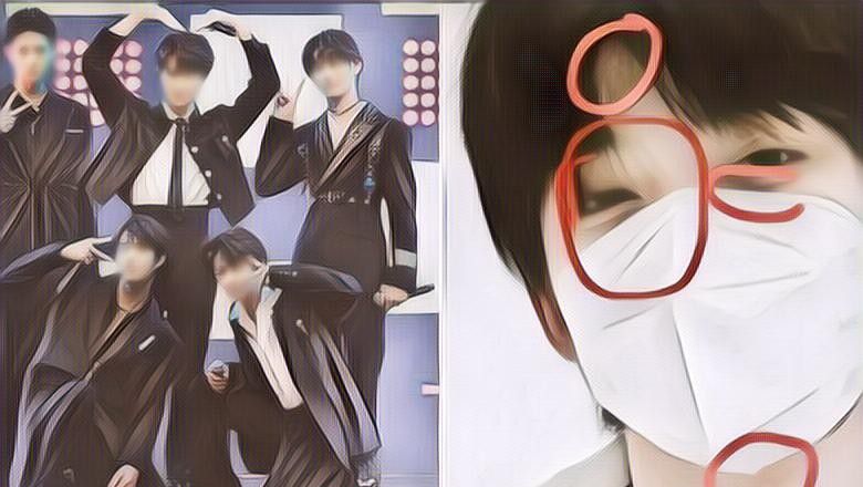 Tega! Diduga Dipukul Leader Grupnya, Idol Ini Ketahuan Datang Ke Acara Dengan Muka Lebam