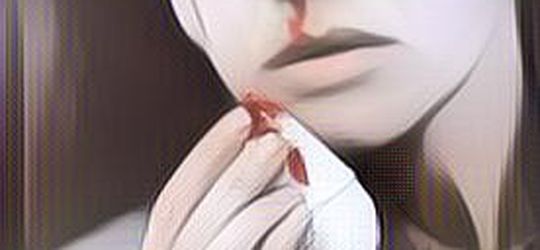 Penyebab Mimisan Tiba-tiba, Begini Lho Cara Penanganannya