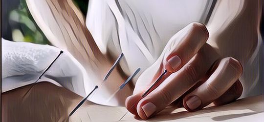 Bagaimana Cara Kerja Akupuntur dan Apa Manfaatnya untuk Kesehatan?