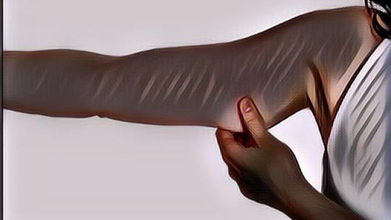 Lengan Sebelah Kiri Kedutan? Siap-siap Bakal Ketiban Rezeki Nomplok