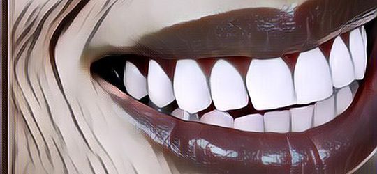 Nggak Perlu Veneer, Ini Tips Bikin Gigi Lebih Putih dan Cerah dengan Bahan Alami