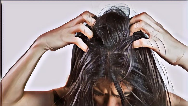 Bikin Khawatir dan Nggak Nyaman, Inilah 5 Penyebab Ketombe Berlebih