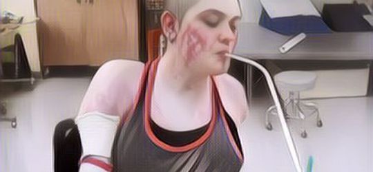 Tangan Kaki Diamputasi Karena Meningitis, Gadis Ini tetap Semangat Jadi Beauty Vlogger