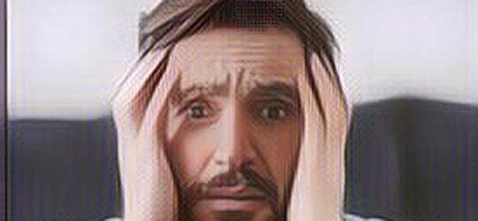 Sering Overthinking dan Anxiety? Coba Deh 5 Cara Ampuh Mengatasi Rasa Cemas Berlebihan Berikut Ini!