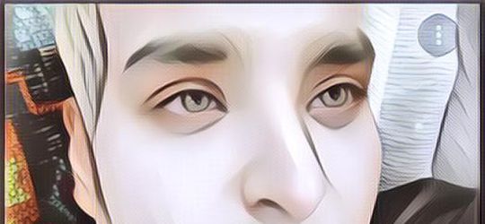 Viral Pria Melakukan Operasi Plastik Bak Filter IG, Hasilnya Bikin Terkejut