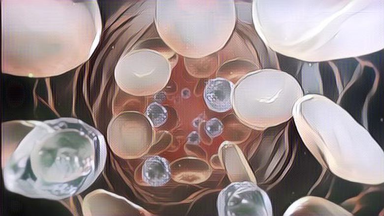 Tak Cuma Jus Jambu, 4 Makanan Ini Juga Bisa Bantu Naikkan Trombosit