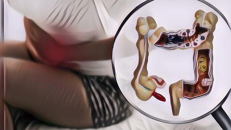 Perutmu Sedang Kembung? Coba Atasi dengan Lakukan Beberapa Gerakan Ini di Rumah