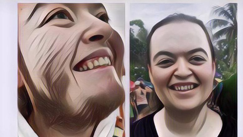 Berjuang Hilangkan Jenggot Selama Bertahun-Tahun, Wanita Ini Memutuskan Hidup Bebas