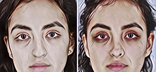 Youtuber Indonesia Ini Bikin Video Soal Operasi Plastik Mereka, Siapa Aja Ya?